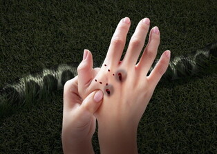 thumbimg