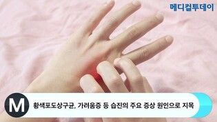 thumbimg