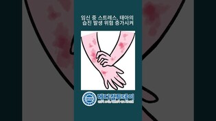 thumbimg
